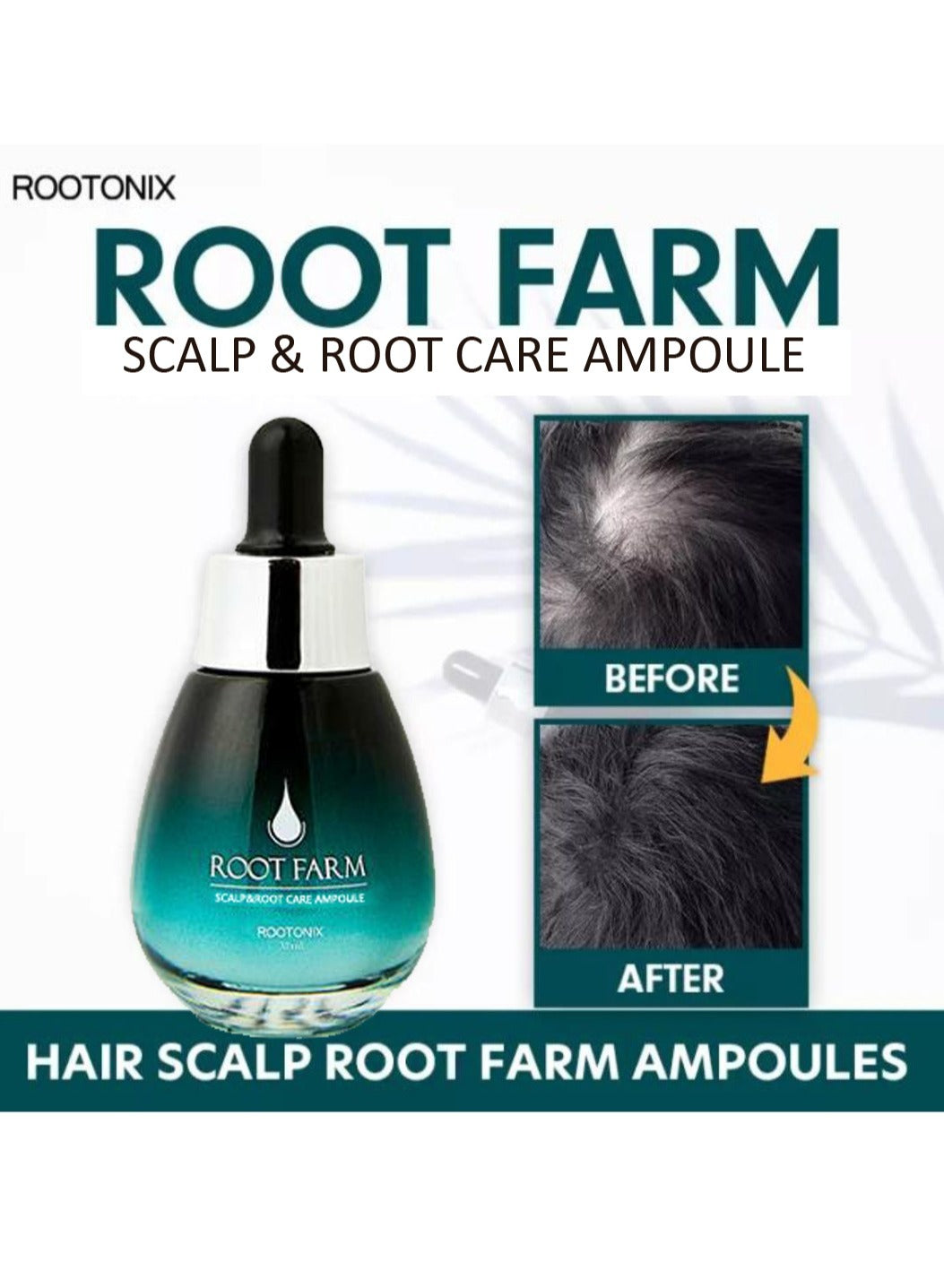 Korean Scalp & Root care Ampoule Hair Loss Treatment Oil 35 ml + Derma Roller 1 mm