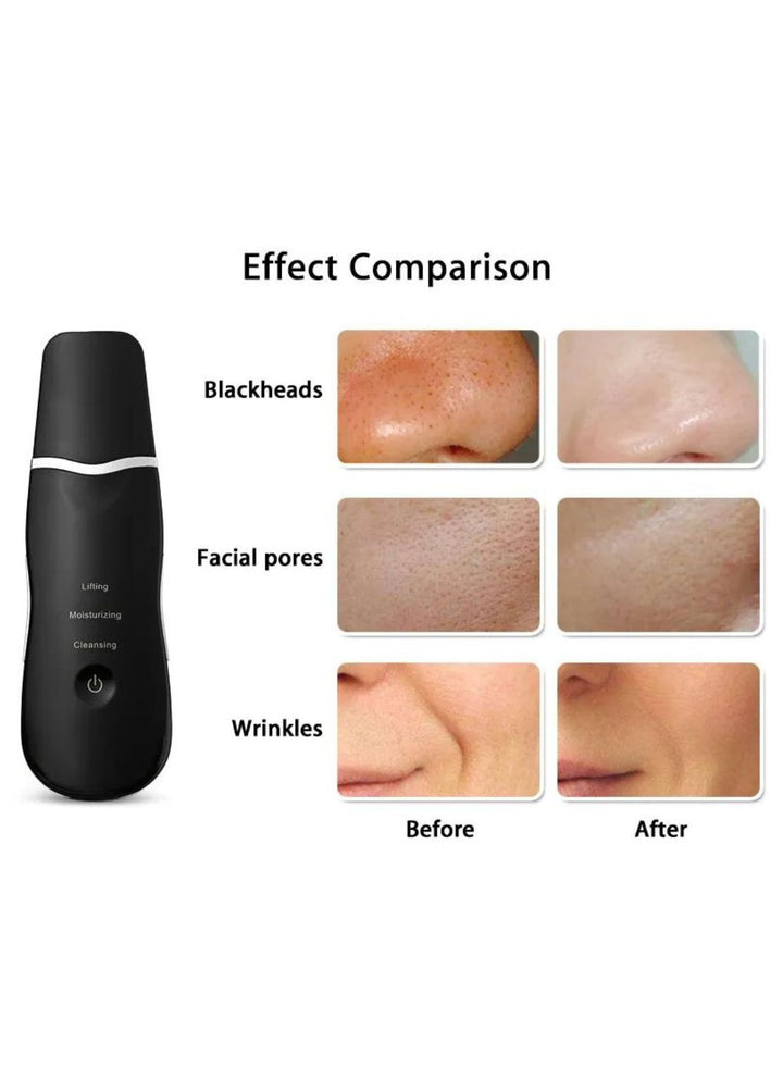 Deep Facial Clean Machine + EMS Slimming LED Therapy Facial Massager + 5 in 1 Face Lift Device + Face Nano Mist Spray