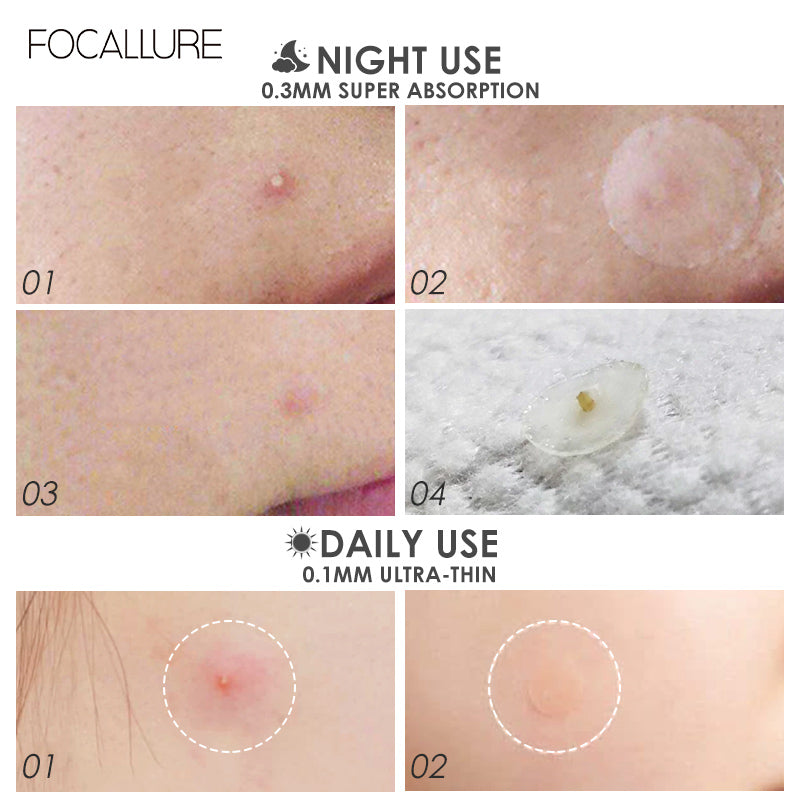 Invisible Acne Pimple Patch for Night Use 2 Pcs