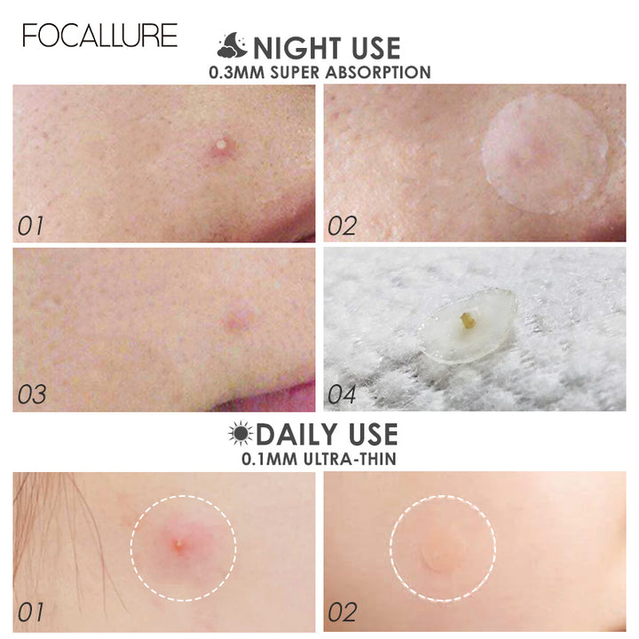 Invisible Acne Pimple Patch for Night Use 2 Pcs