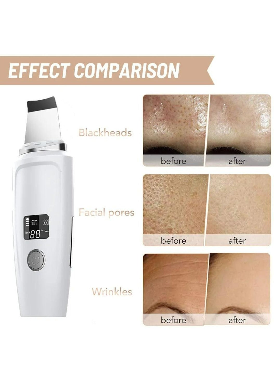 Blackhead Remover 4 in 1 Deep Cleansing Instrument