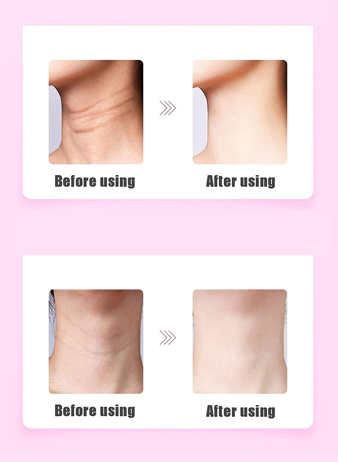 Face, Neck Firming Anti-Wrinkle Skin Tightening Machine